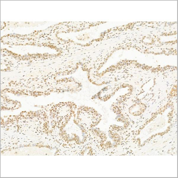product-image-AAA31251_IHC8.jpg