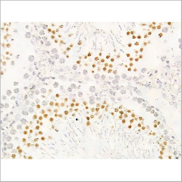 product-image-AAA31252_IHC3.jpg