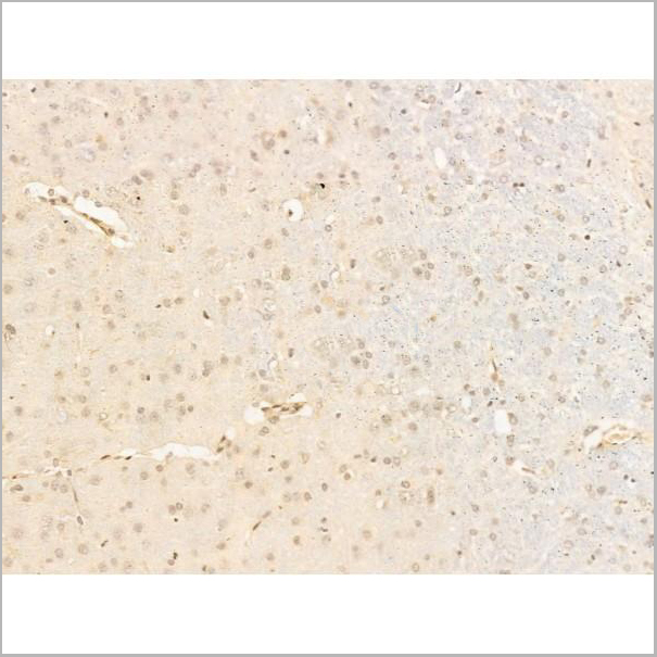 product-image-AAA31252_IHC4.jpg