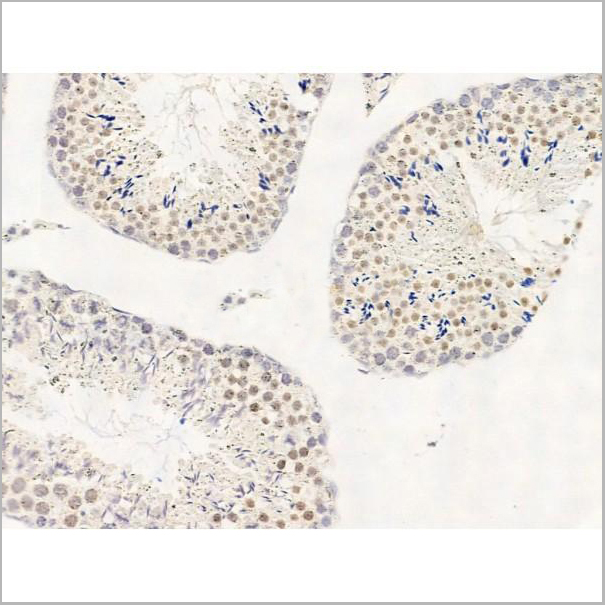 product-image-AAA31252_IHC5.jpg