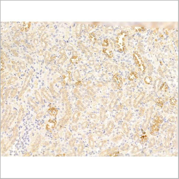 product-image-AAA31253_IHC3.jpg