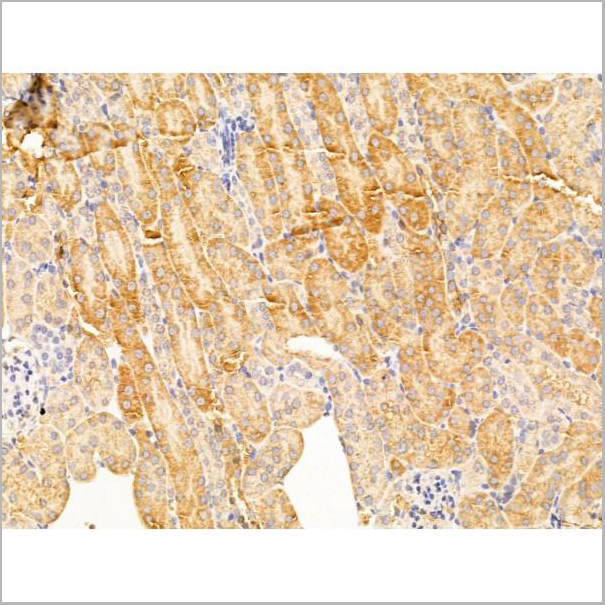 product-image-AAA31253_IHC6.jpg