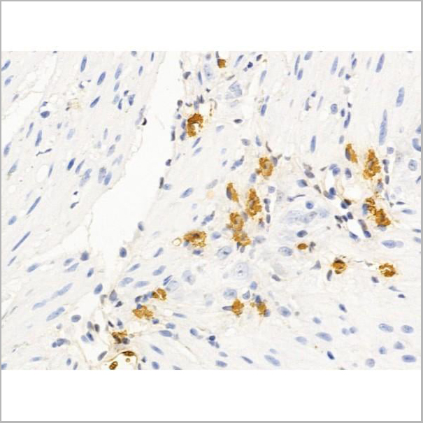 product-image-AAA31254_IHC10.jpg