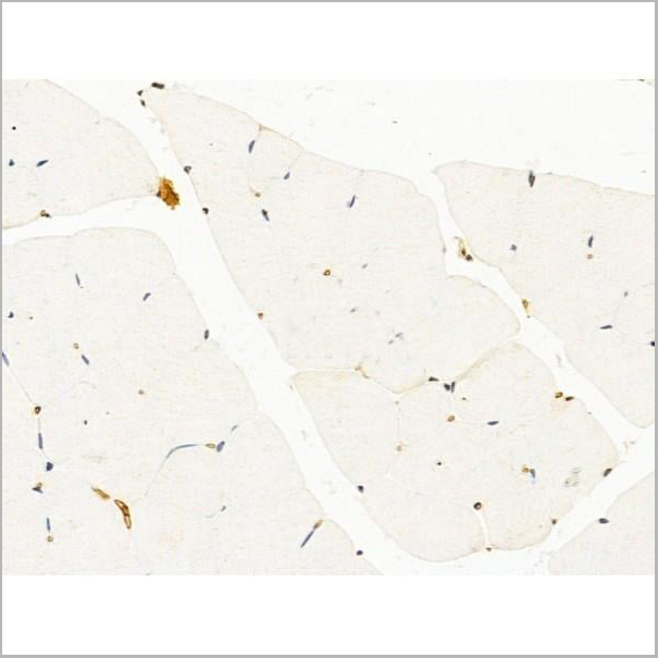 product-image-AAA31254_IHC11.jpg