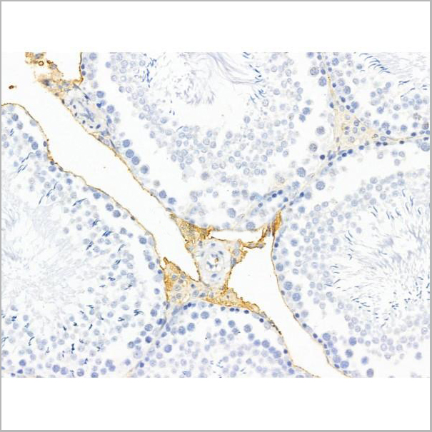 product-image-AAA31254_IHC2.jpg