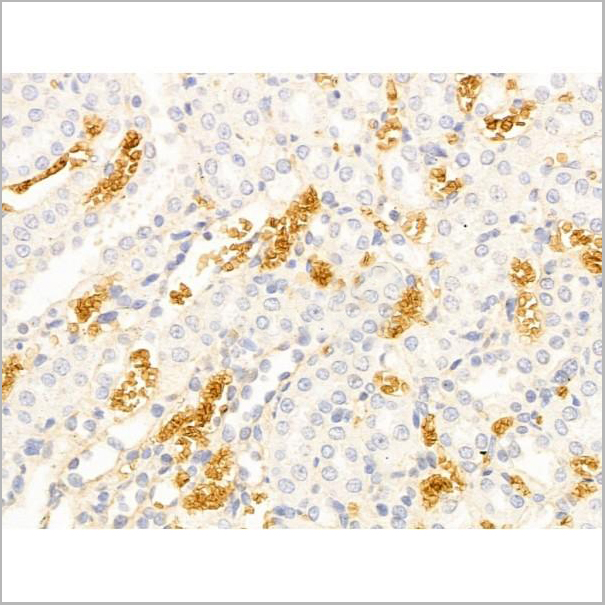 product-image-AAA31254_IHC4.jpg