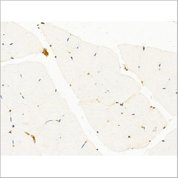 product-image-AAA31254_IHC8.jpg