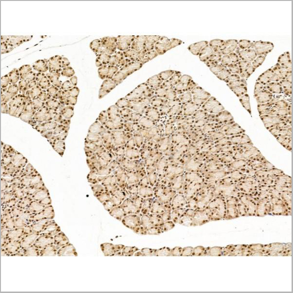 product-image-AAA31255_IHC5.jpg