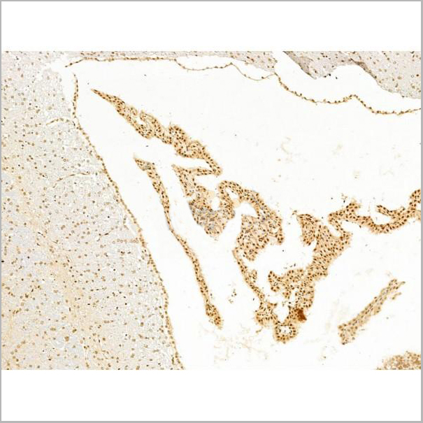 product-image-AAA31255_IHC6.jpg