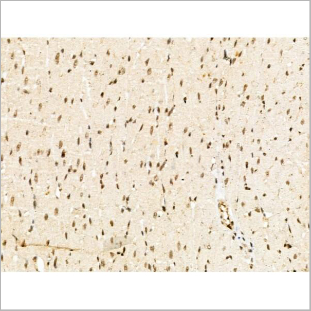 product-image-AAA31255_IHC9.jpg