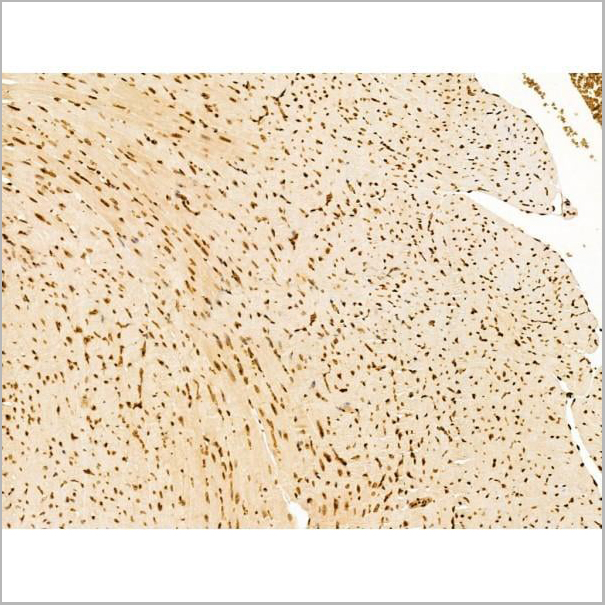 product-image-AAA31256_IHC10.jpg