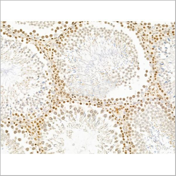product-image-AAA31256_IHC2.jpg