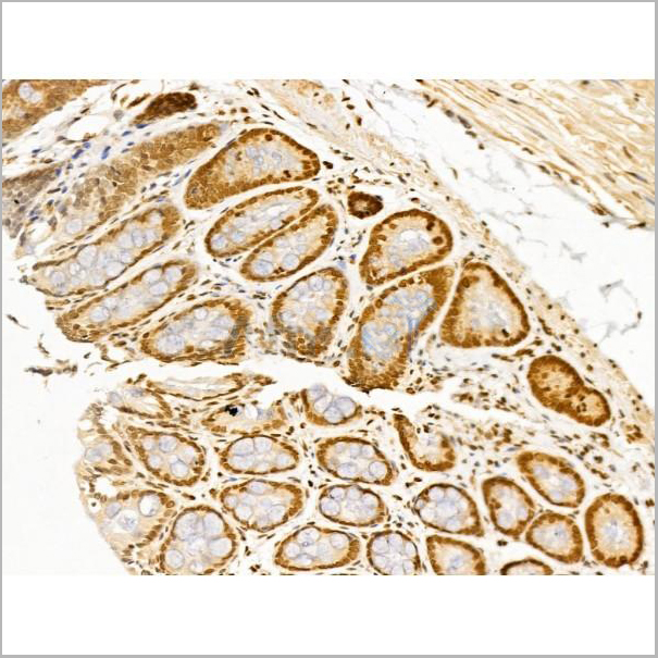product-image-AAA31256_IHC3.jpg