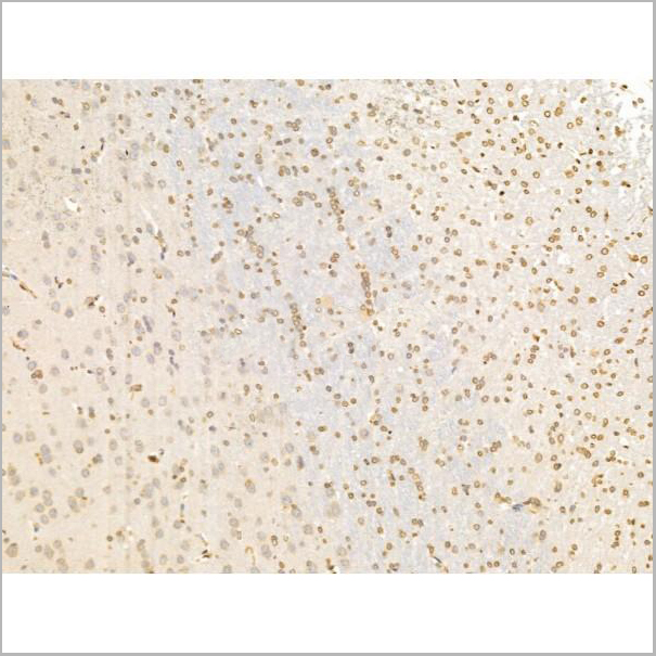 product-image-AAA31256_IHC4.jpg