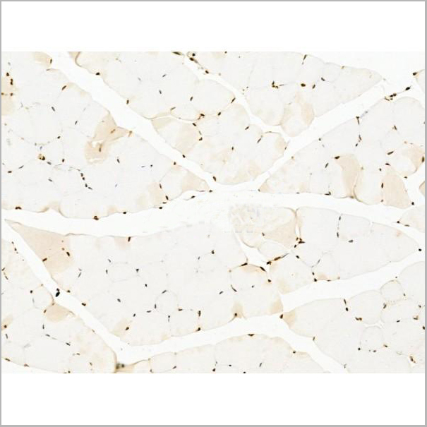product-image-AAA31256_IHC5.jpg