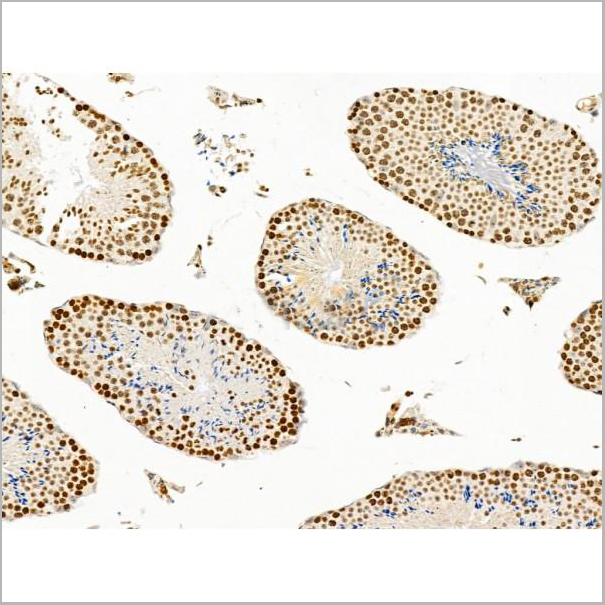 product-image-AAA31256_IHC6.jpg