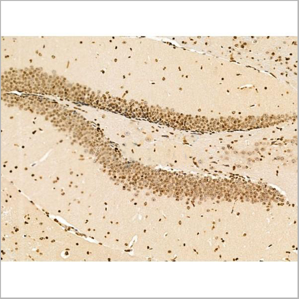 product-image-AAA31256_IHC8.jpg