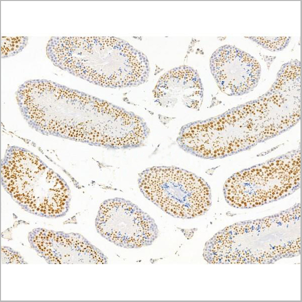 product-image-AAA31257_IHC2.jpg