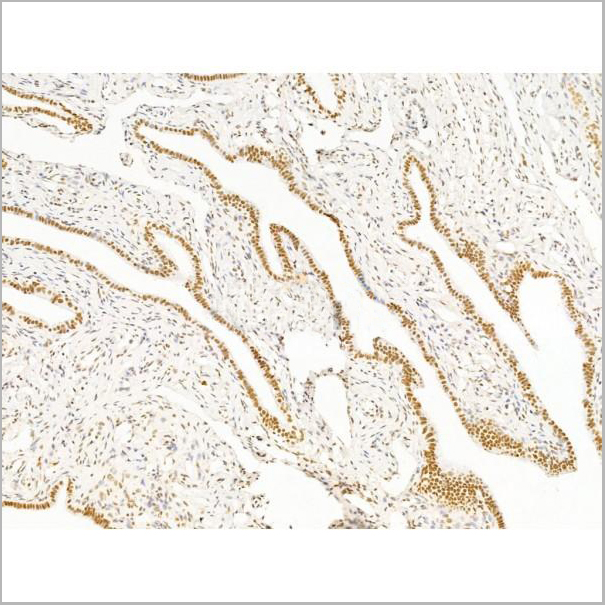 product-image-AAA31257_IHC3.jpg