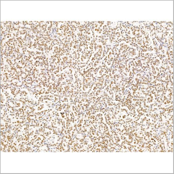 product-image-AAA31257_IHC4.jpg