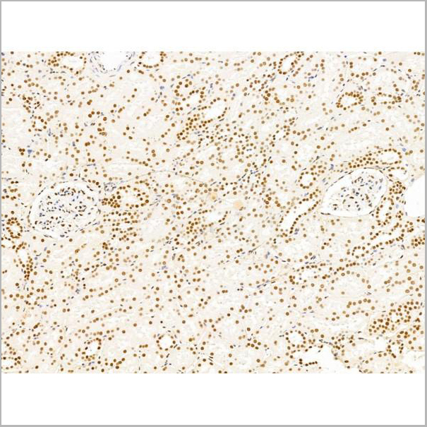 product-image-AAA31257_IHC5.jpg