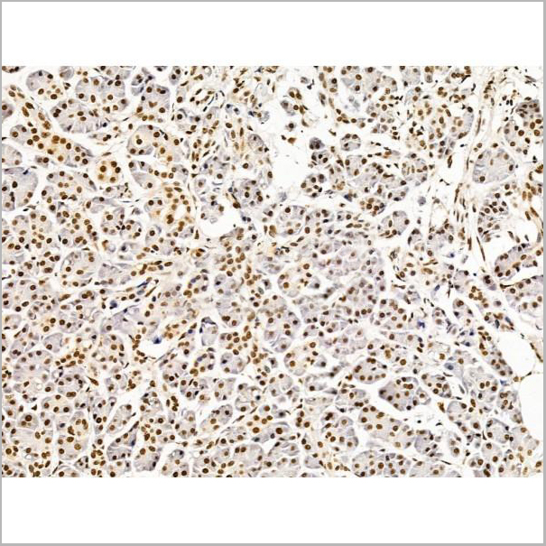 product-image-AAA31257_IHC8.jpg