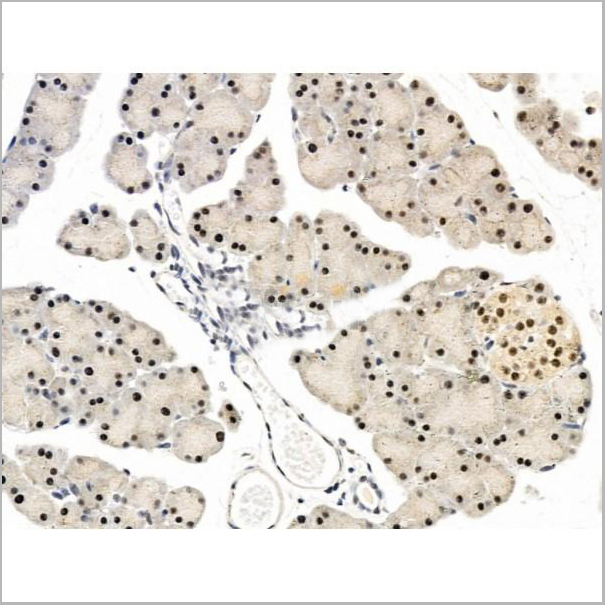 product-image-AAA31258_IHC2.jpg