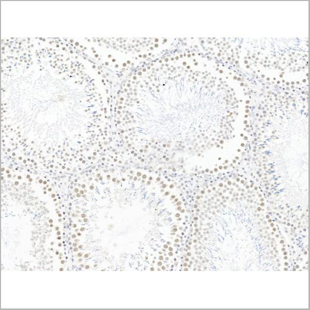 product-image-AAA31258_IHC3.jpg