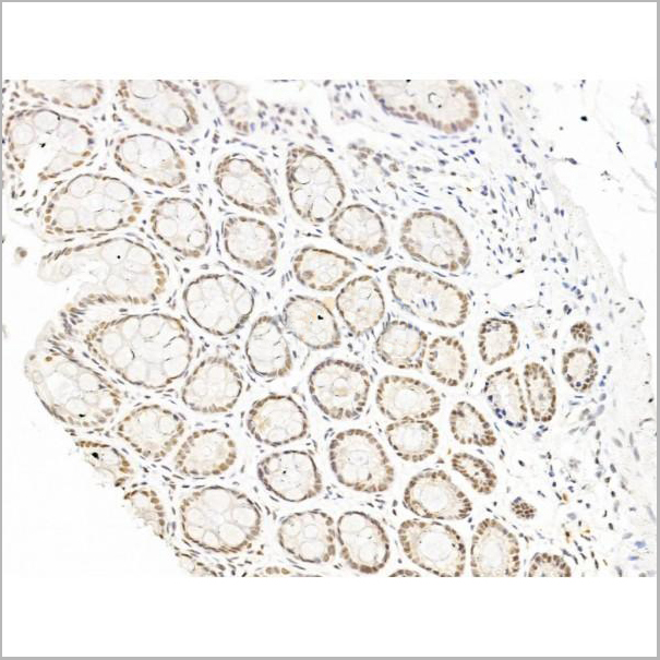 product-image-AAA31258_IHC4.jpg