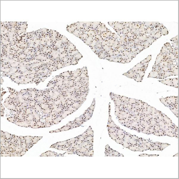 product-image-AAA31258_IHC5.jpg