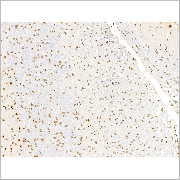 product-image-AAA31258_IHC6.jpg
