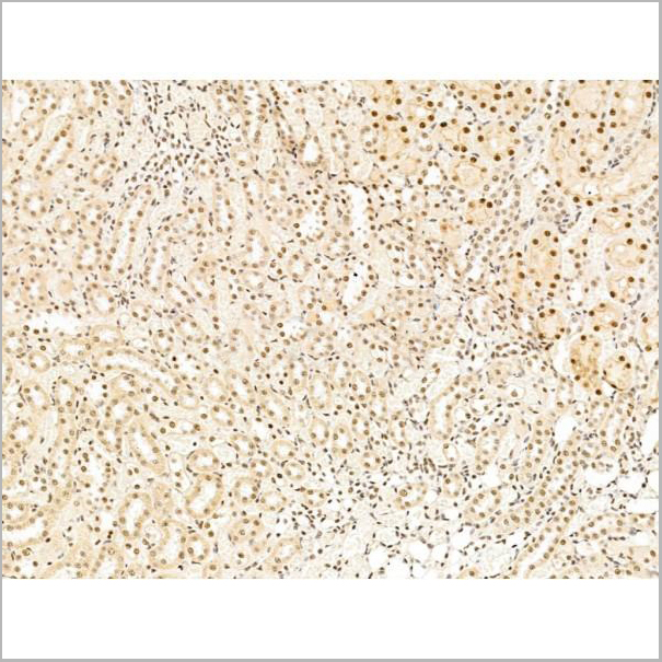 product-image-AAA31258_IHC7.jpg