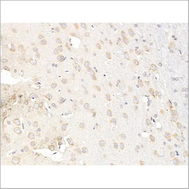 product-image-AAA31259_IHC2.jpg