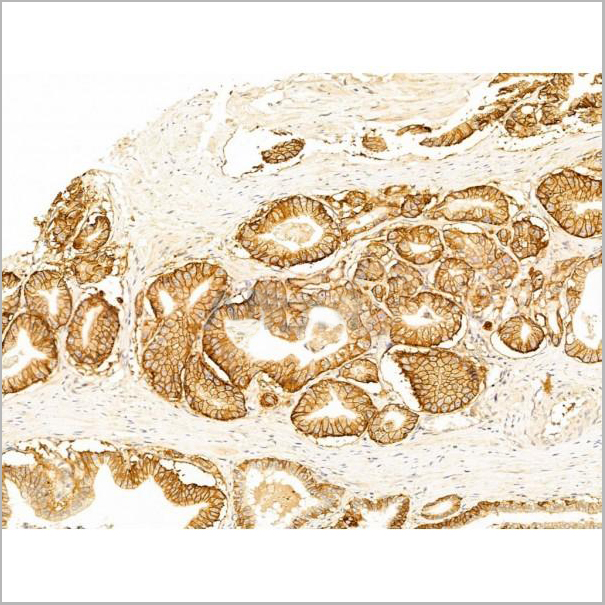 product-image-AAA31259_IHC4.jpg