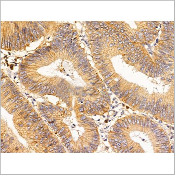 product-image-AAA31259_IHC6.jpg