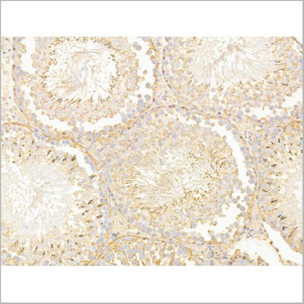 product-image-AAA31260_IHC2.jpg