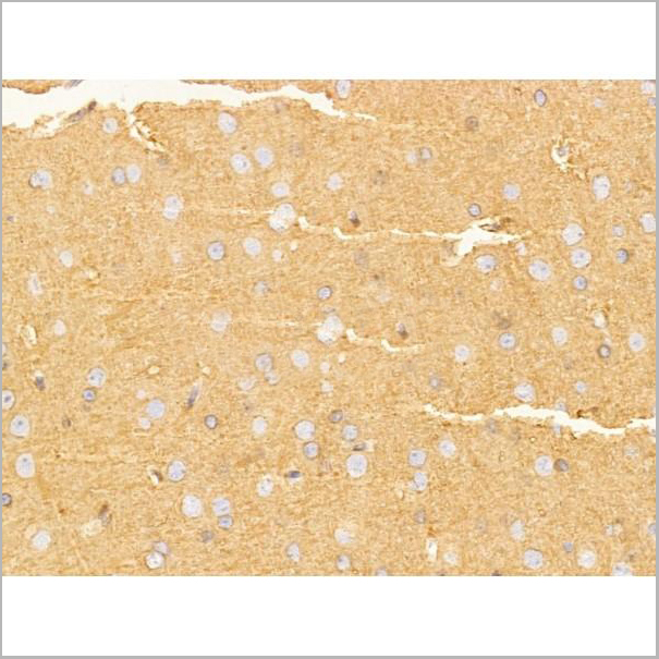 product-image-AAA31260_IHC3.jpg