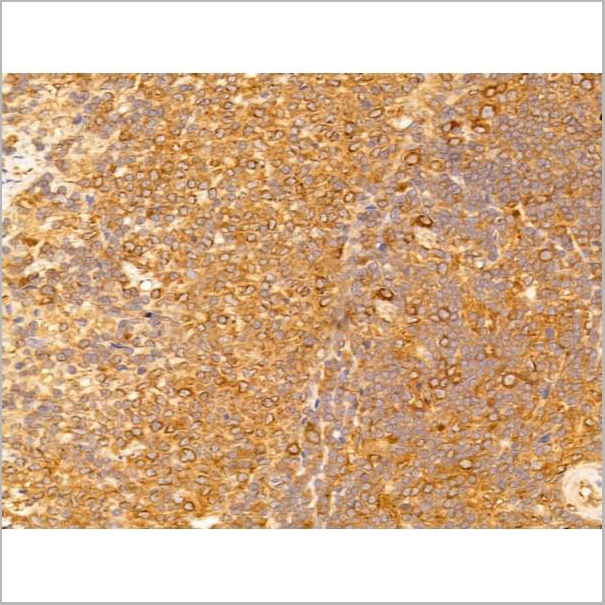 product-image-AAA31260_IHC4.jpg
