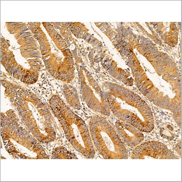 product-image-AAA31261_IHC5.jpg