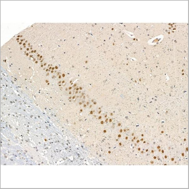 product-image-AAA31262_IHC3.jpg