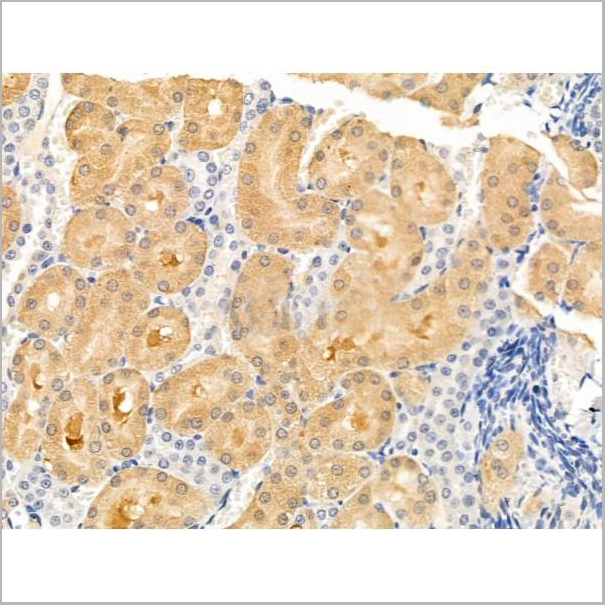 product-image-AAA31262_IHC4.jpg