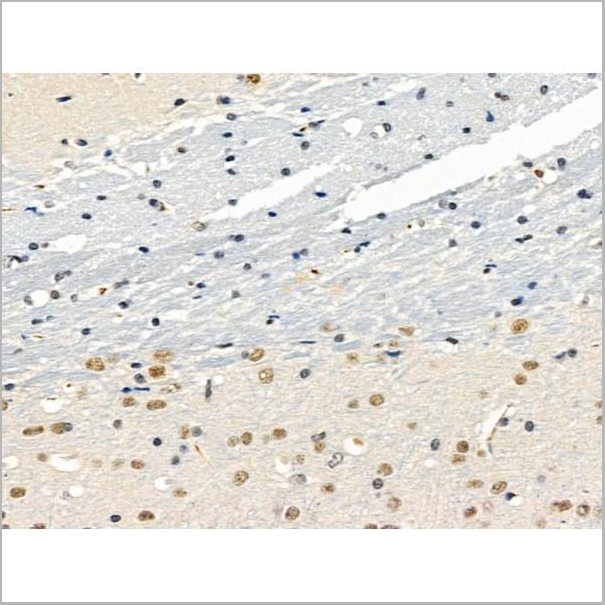 product-image-AAA31262_IHC5.jpg