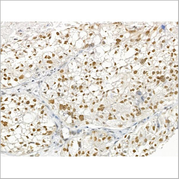 product-image-AAA31263_IHC3.jpg