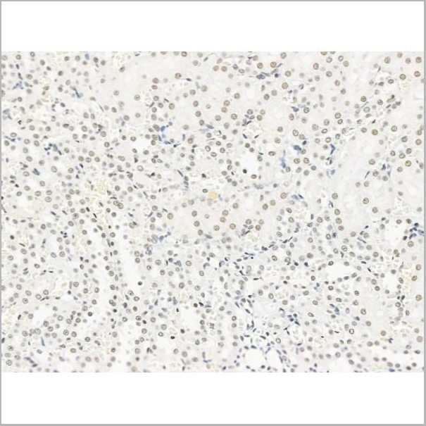 product-image-AAA31263_IHC8.jpg