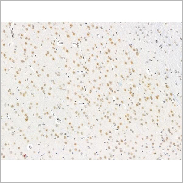 product-image-AAA31264_IHC2.jpg