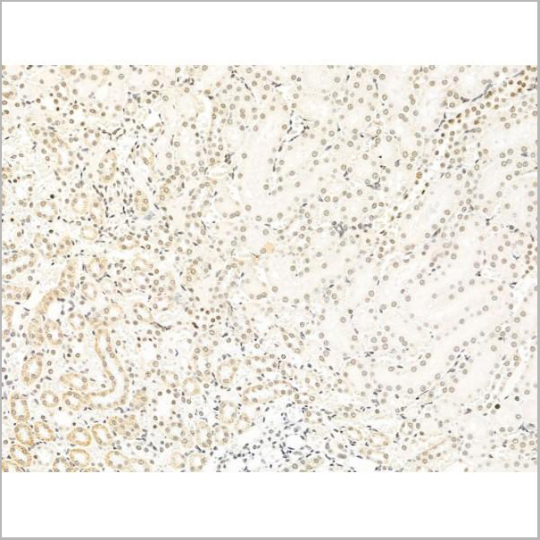 product-image-AAA31264_IHC3.jpg