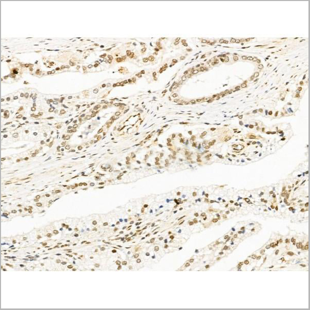 product-image-AAA31264_IHC8.jpg