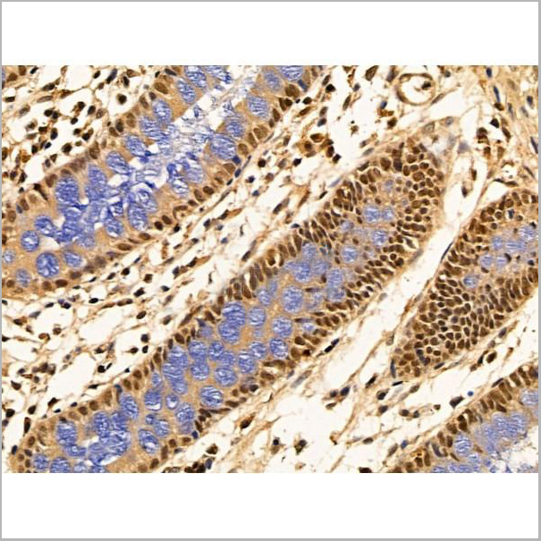 product-image-AAA31265_IHC6.jpg