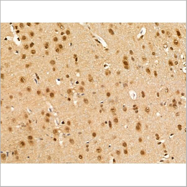 product-image-AAA31266_IHC2.jpg