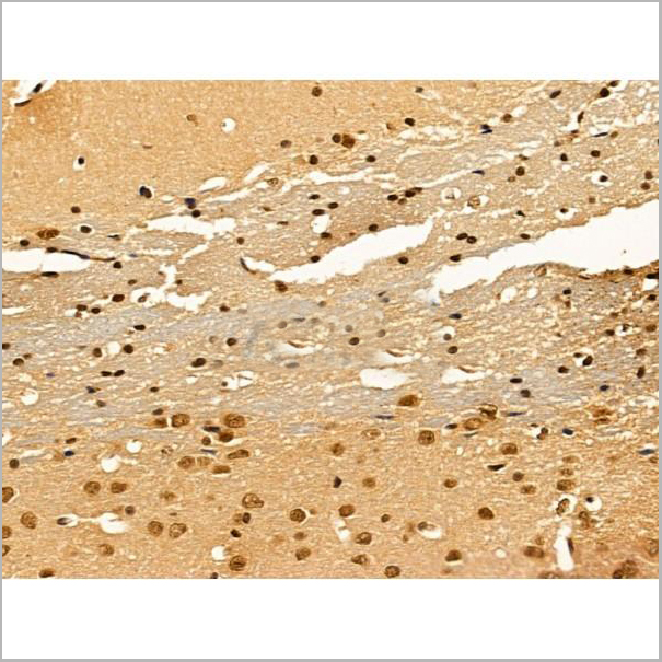 product-image-AAA31266_IHC5.jpg